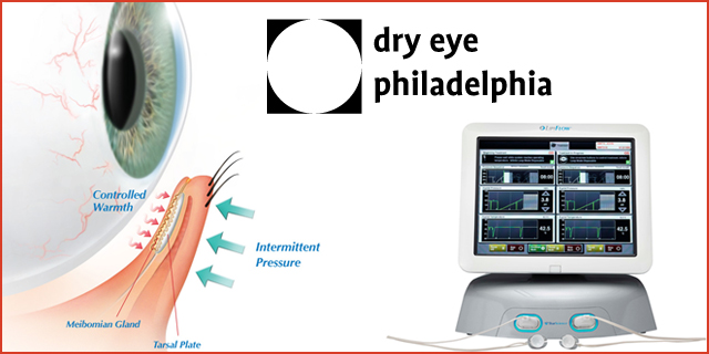 Treatment for Dry Eye